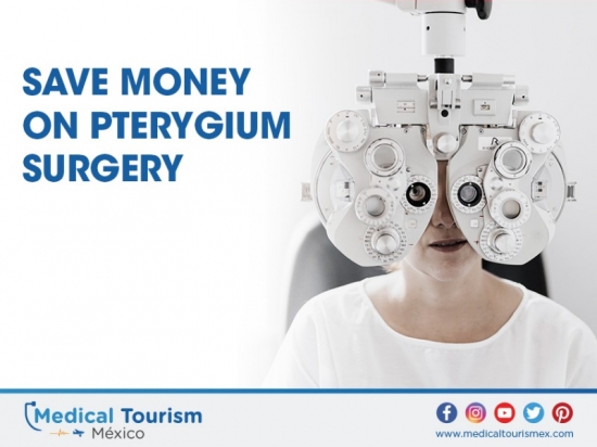 Save money on pterygium surgery in Merida